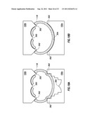 TUBULAR SEVERING SYSTEM AND METHOD OF USING SAME diagram and image