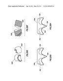 TUBULAR SEVERING SYSTEM AND METHOD OF USING SAME diagram and image