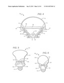 LED LAMP WITH REMOTE PHOSPHOR AND DIFFUSER CONFIGURATION UTILIZING RED     EMITTERS diagram and image