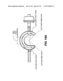 EXTREMITY IMAGING APPARATUS FOR CONE BEAM COMPUTED TOMOGRAPHY diagram and image