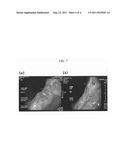 Composition for Cancer Prevention or Treatment Containing as Active     Ingredient Plant Stem Cell Line Dervied from Cambium of Panax Ginseng     Including Wild Ginseng or Ginseng diagram and image