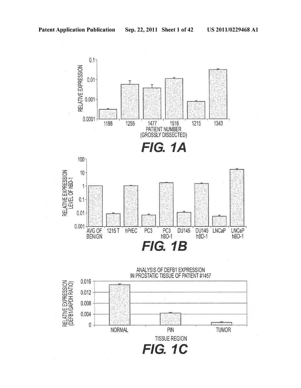 TARGETING PAX2 FOR THE TREATMENT OF BREAST CANCER - diagram, schematic, and image 02