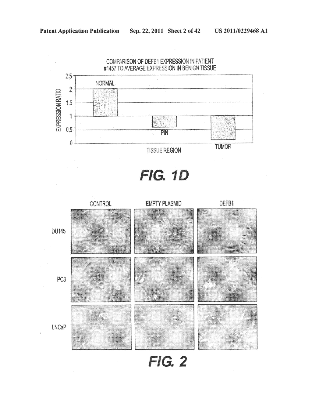 TARGETING PAX2 FOR THE TREATMENT OF BREAST CANCER - diagram, schematic, and image 03