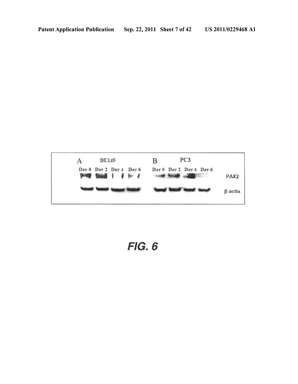 TARGETING PAX2 FOR THE TREATMENT OF BREAST CANCER - diagram, schematic, and image 08