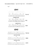 GENETIC ALTERATIONS IN ISOCITRATE DEHYDROGENASE AND OTHER GENES IN     MALIGNANT GLIOMA diagram and image