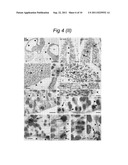 NOVEL mRNA SPLICE VARIANT OF THE DOUBLECORTIN-LIKE KINASE GENE AND ITS USE     IN DIAGNOSIS AND THERAPY OF CANCERS OF NEUROECTODERMAL ORIGIN diagram and image