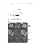 NOVEL mRNA SPLICE VARIANT OF THE DOUBLECORTIN-LIKE KINASE GENE AND ITS USE     IN DIAGNOSIS AND THERAPY OF CANCERS OF NEUROECTODERMAL ORIGIN diagram and image