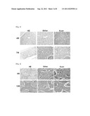 AGENT FOR TREATING MYELOFIBROSIS diagram and image