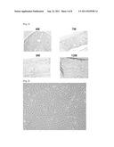 AGENT FOR TREATING MYELOFIBROSIS diagram and image