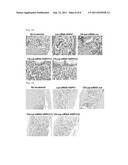 AGENT FOR TREATING MYELOFIBROSIS diagram and image