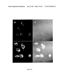 NA CHANNELS, DISEASE, AND RELATED ASSAYS AND COMPOSITIONS diagram and image