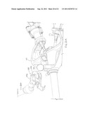 Active Instrument Port System for Minimally-Invasive Surgical Procedures diagram and image