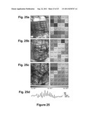 IMPLANTABLE BIOMEDICAL DEVICES ON BIORESORBABLE SUBSTRATES diagram and image