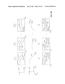 System and method for determining the position of the tip of a medical     catheter within the body of a patient diagram and image