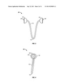 Arterial Tamponade Device and Method diagram and image