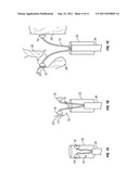 Arterial Tamponade Device and Method diagram and image