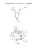 Arterial Tamponade Device and Method diagram and image