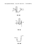 Arterial Tamponade Device and Method diagram and image