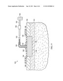 EPITHELIALIZATION METHODS, DRESSINGS, AND SYSTEMS diagram and image