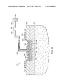 EPITHELIALIZATION METHODS, DRESSINGS, AND SYSTEMS diagram and image