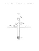 Fluid Absorbent Surgical Device for Trocars diagram and image