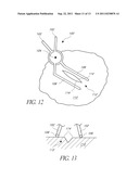 METHODS OF LIGHT TREATMENT OF WOUNDS TO REDUCE SCAR FORMATION diagram and image