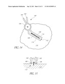 METHODS OF LIGHT TREATMENT OF WOUNDS TO REDUCE SCAR FORMATION diagram and image