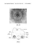 Patient Selectable Joint Arthroplasty Devices and Surgical Tools diagram and image