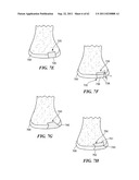 Patient Selectable Joint Arthroplasty Devices and Surgical Tools diagram and image