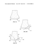 Patient Selectable Joint Arthroplasty Devices and Surgical Tools diagram and image