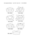 Patient Selectable Joint Arthroplasty Devices and Surgical Tools diagram and image