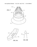 Patient Selectable Joint Arthroplasty Devices and Surgical Tools diagram and image