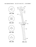 Patient Selectable Joint Arthroplasty Devices and Surgical Tools diagram and image