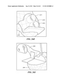 Patient Selectable Joint Arthroplasty Devices and Surgical Tools diagram and image