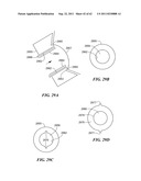 Patient Selectable Joint Arthroplasty Devices and Surgical Tools diagram and image