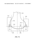 Patient Selectable Joint Arthroplasty Devices and Surgical Tools diagram and image