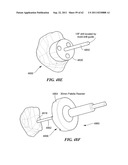 Patient Selectable Joint Arthroplasty Devices and Surgical Tools diagram and image