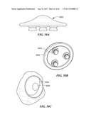 Patient Selectable Joint Arthroplasty Devices and Surgical Tools diagram and image