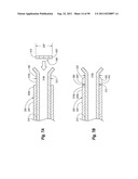 CLIP APPLIER AND METHODS OF USE diagram and image