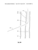 CLIP APPLIER AND METHODS OF USE diagram and image