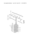 CLIP APPLIER AND METHODS OF USE diagram and image