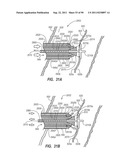 CLIP APPLIER AND METHODS OF USE diagram and image