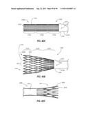 CLIP APPLIER AND METHODS OF USE diagram and image