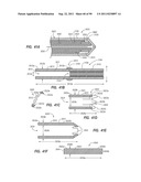 CLIP APPLIER AND METHODS OF USE diagram and image