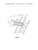 CLIP APPLIER AND METHODS OF USE diagram and image