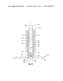 CLIP APPLIER AND METHODS OF USE diagram and image