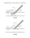 CLIP APPLIER AND METHODS OF USE diagram and image