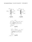 CLIP APPLIER AND METHODS OF USE diagram and image