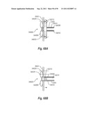 CLIP APPLIER AND METHODS OF USE diagram and image