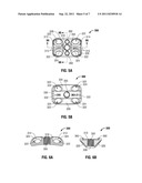 ANTERIOR BRACKET FOR SPINAL FIXATION diagram and image